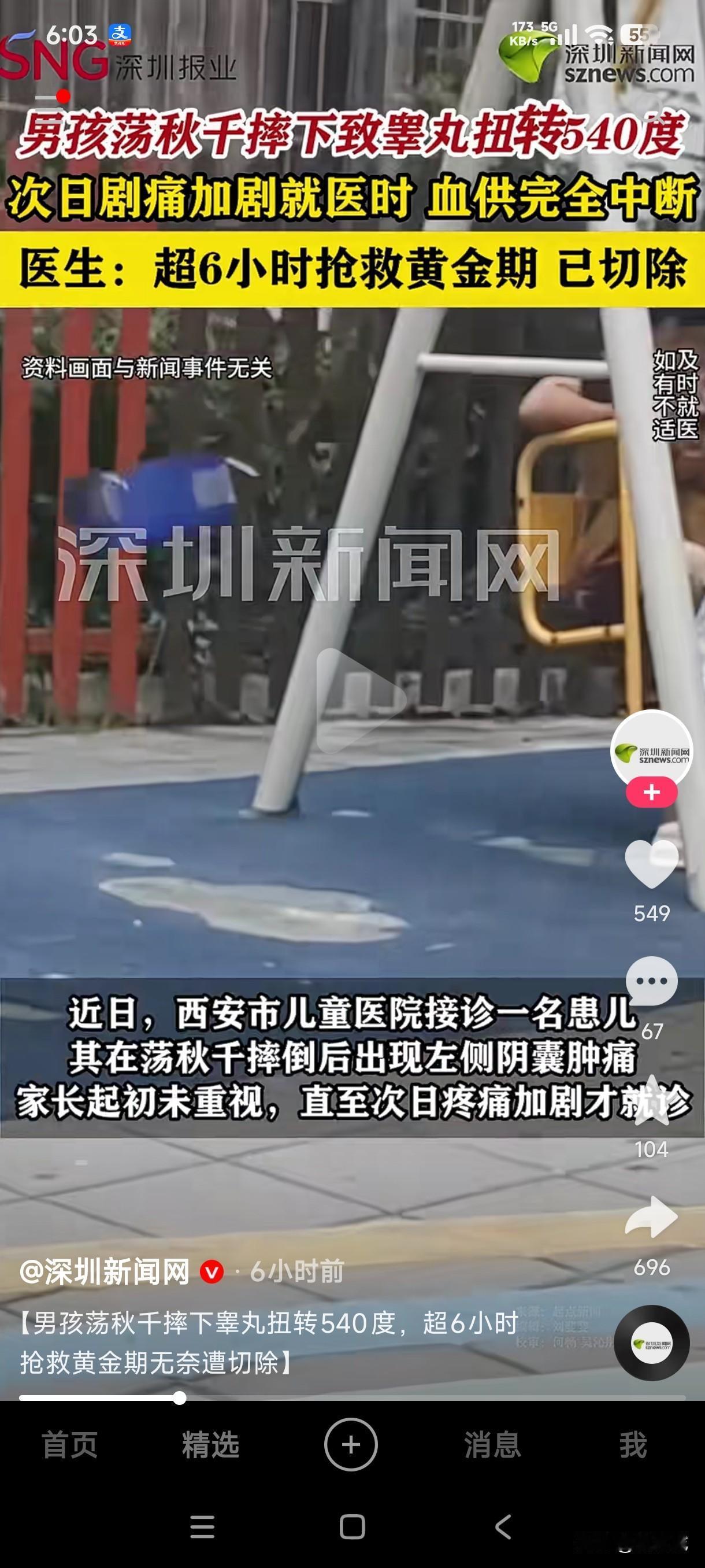 陕西一男孩荡秋千时不慎摔下导致睾丸扭转540度，第二天疼痛加重时才去就医，血供完