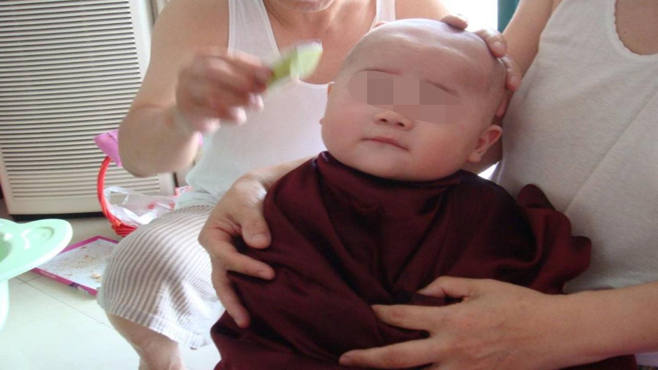 宝宝毛囊坏死, 以后长不出头发, 只因宝妈做了一件这么无知的事情