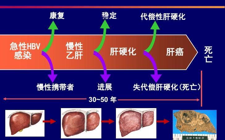 肝硬化患者别灰心！中医调理让你远离肝硬化，坚持一辈子不反复！大家好，我是北京公