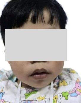 【#3岁男童长期吃隔夜饭菜中毒进ICU#】#男童长期吃剩菜血液变异常紫黑色#提到食物中毒，大多数家长