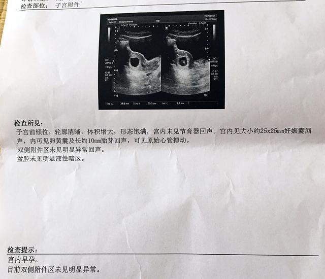 宝爸陪孕日记~第一次孕检, 宝妈都检查什么? 花多少钱? 附清单!