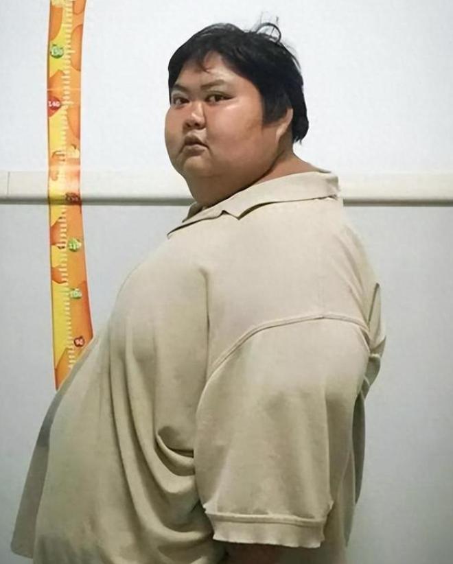 1.45米的身高，356斤的体重，一个女人的身体里装着三个成年人的分量。家里2米