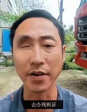 一只眼睛没了，去办残疾证，工作人员说办不了，因为你另一只眼好使，不影响正常生活。