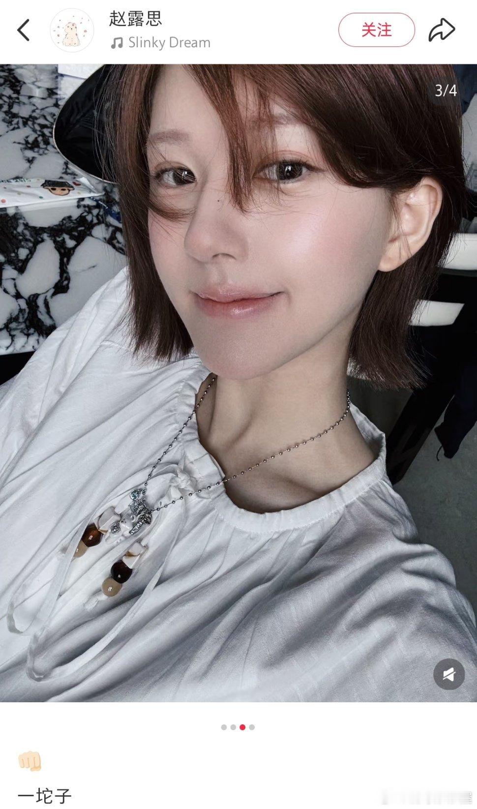赵露思更新一组新照片，胳膊没有任何痕迹赵露思胳膊怎么了​​​