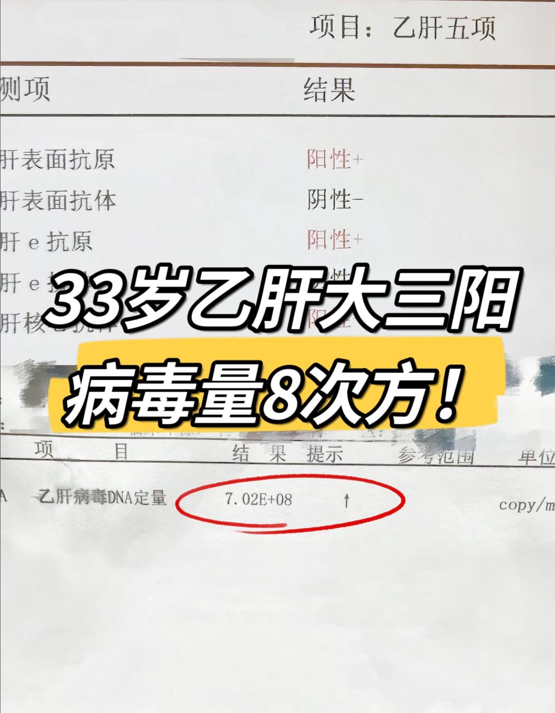 上亿的病毒量啊！ 我一个患者，这个姑娘大三阳，有家族史，她母亲有所以她...