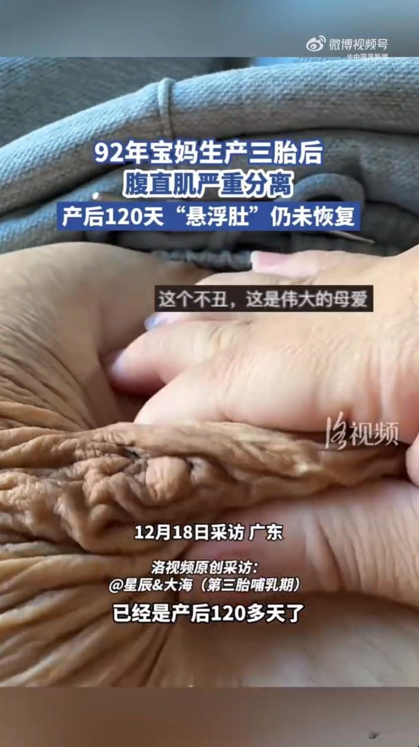 广东一位92年的宝妈，生完三胎后遇到的情况让很多人看了都心疼，本来以为生完孩子肚