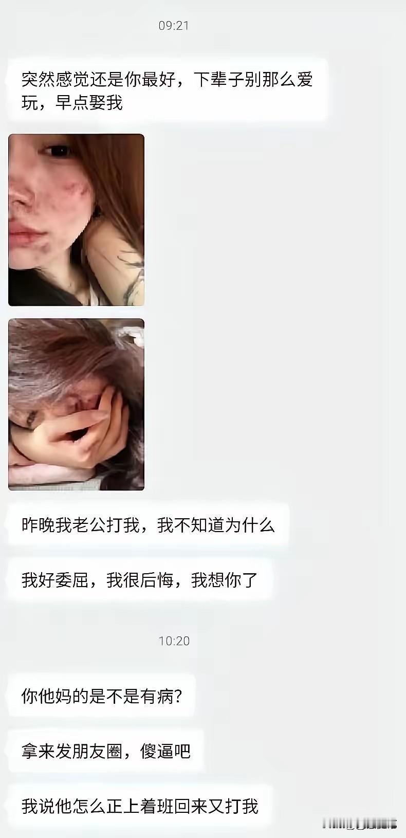 讲真，这事儿气得我手抖。一个女生被老公打了。浑身疼，心里更疼。不知道该找