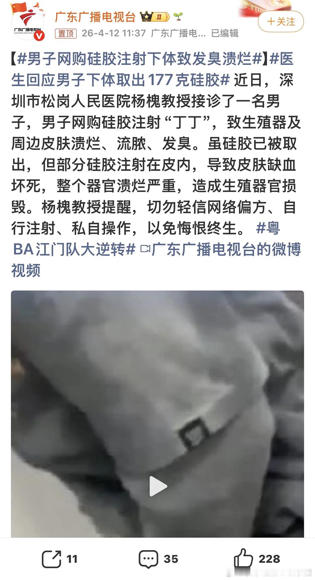 我的天​​​