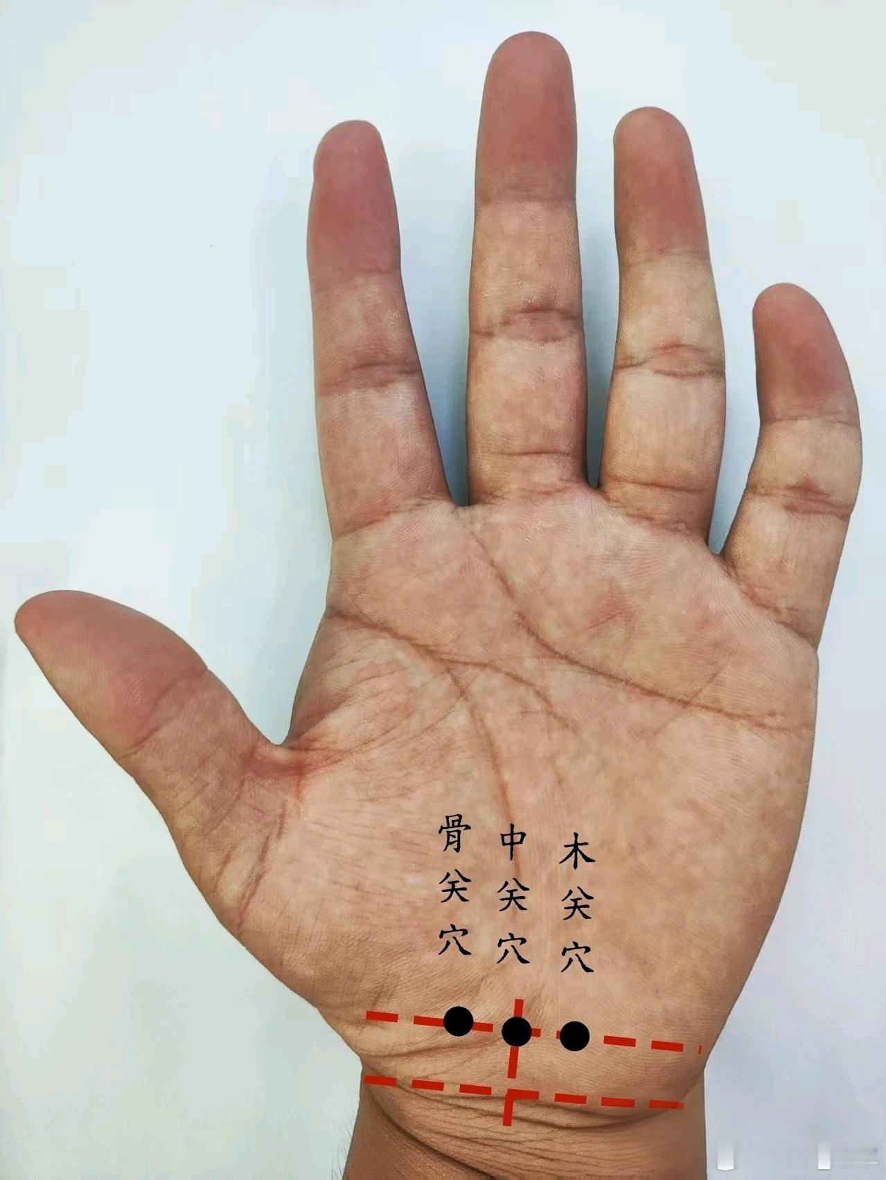 骨关穴、木关穴、中关穴治疗尿酸过高骨关穴、木关穴、中关穴源自董氏奇穴位置：手掌