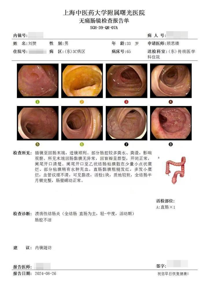 溃结反复的根源：症状一好就停药！。停药一年，溃疡性结肠炎从直肠增加到回...