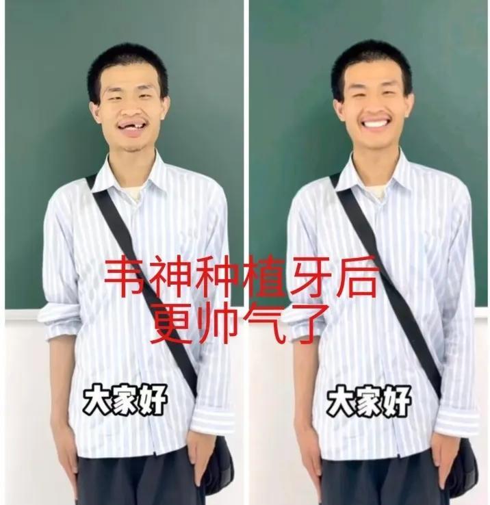 韦神的牙，是个大商机！有没有哪个牙科医院主动帮韦神修复好牙齿的？虽然花点钱，但