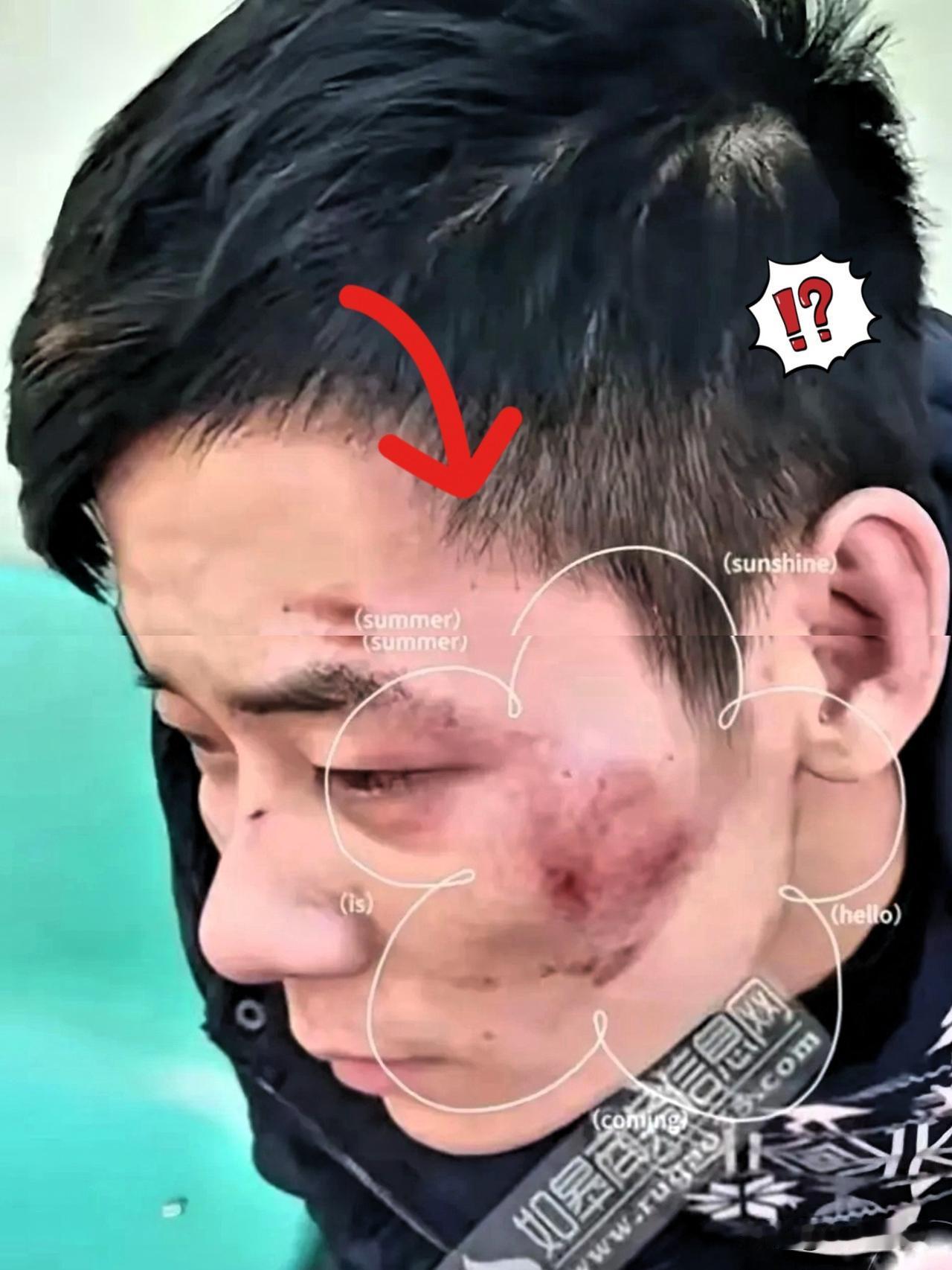 5月10号凌晨，四川街头，一位大哥运气爆棚！大半夜被6个人追得狼狈不堪，眼看就要