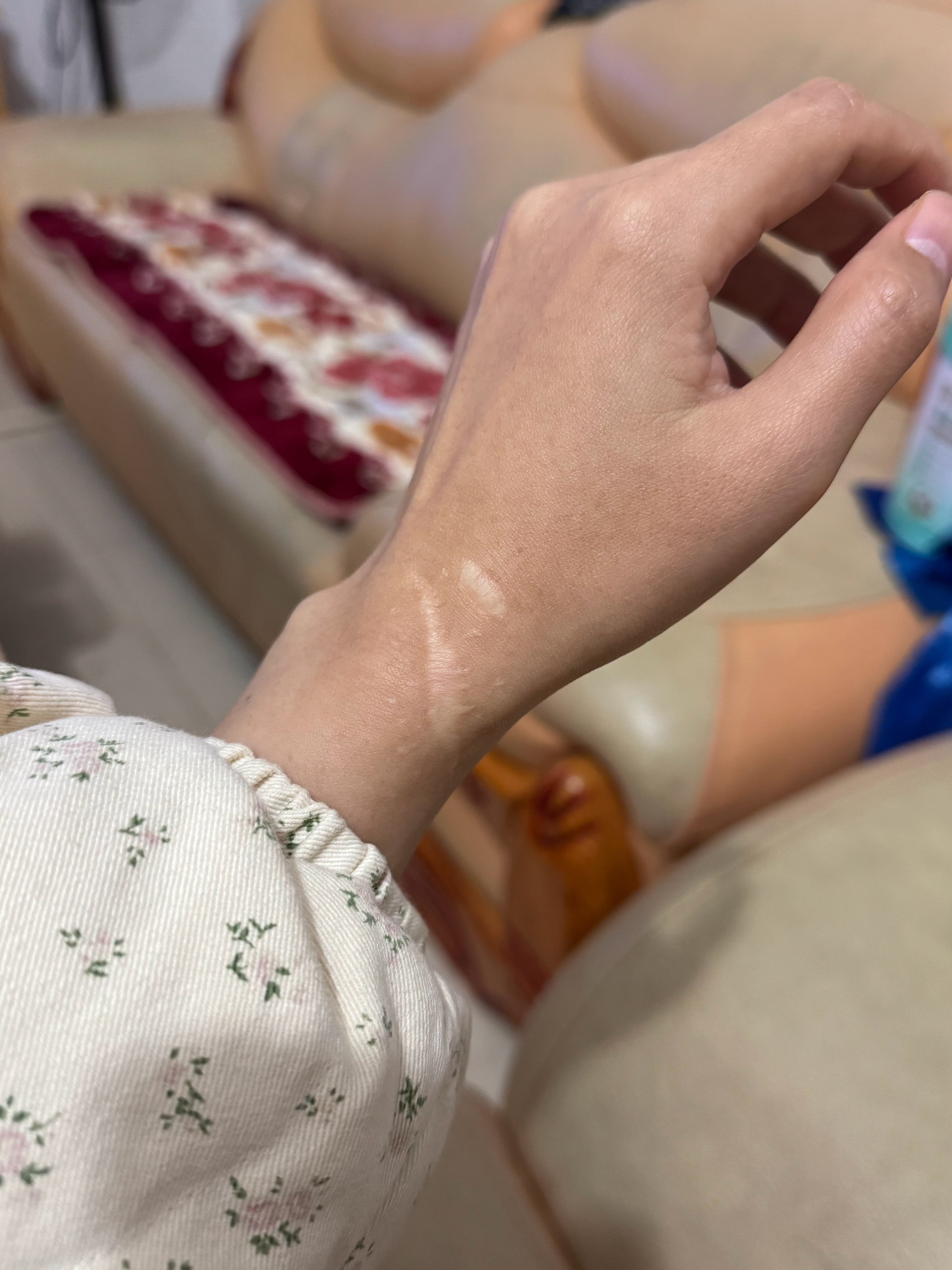 我手上有一道疤，连我爸妈都不知道。小时候爸妈外出务工，把我送回老家跟着爷爷奶奶生