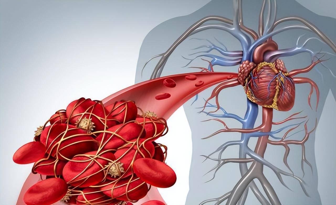 一、开头：天冷心脑血管易“受伤”！这4个原则能帮你避开风险 一到冬天，