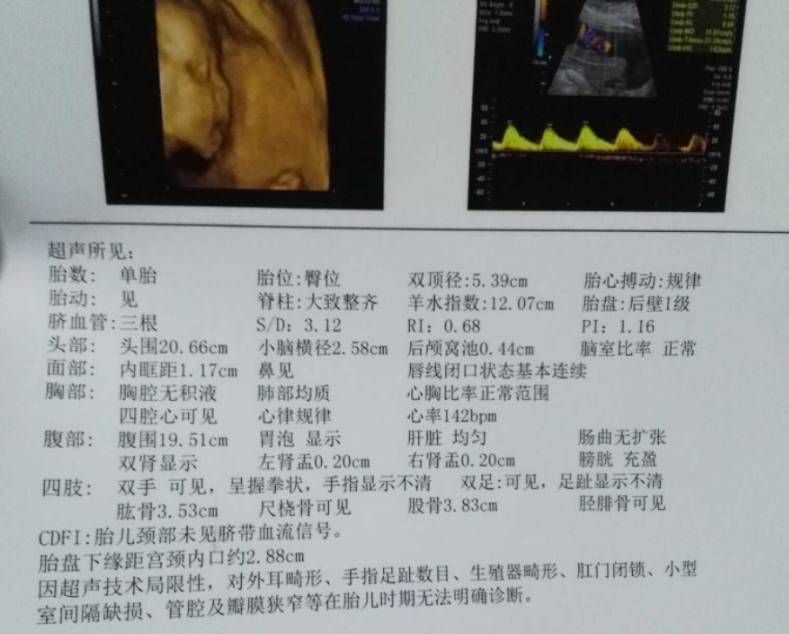 接女宝啦, 预产期1月31号, 25号迫不及待出来了, 6.5斤的小棉袄