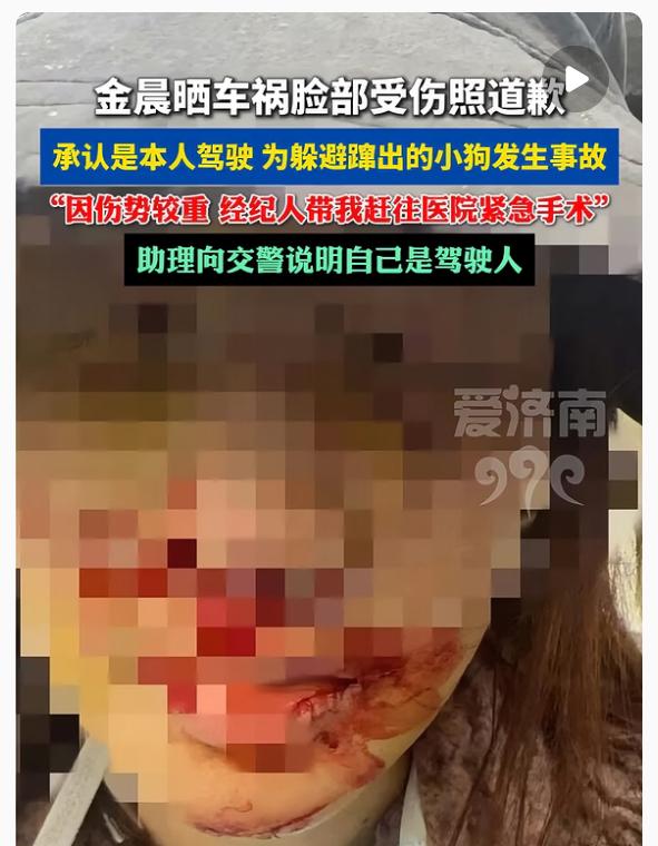 金晨这孩子，不能仔细看，越仔细看，越会发现。去年三月那起事故被翻出来，说是她开