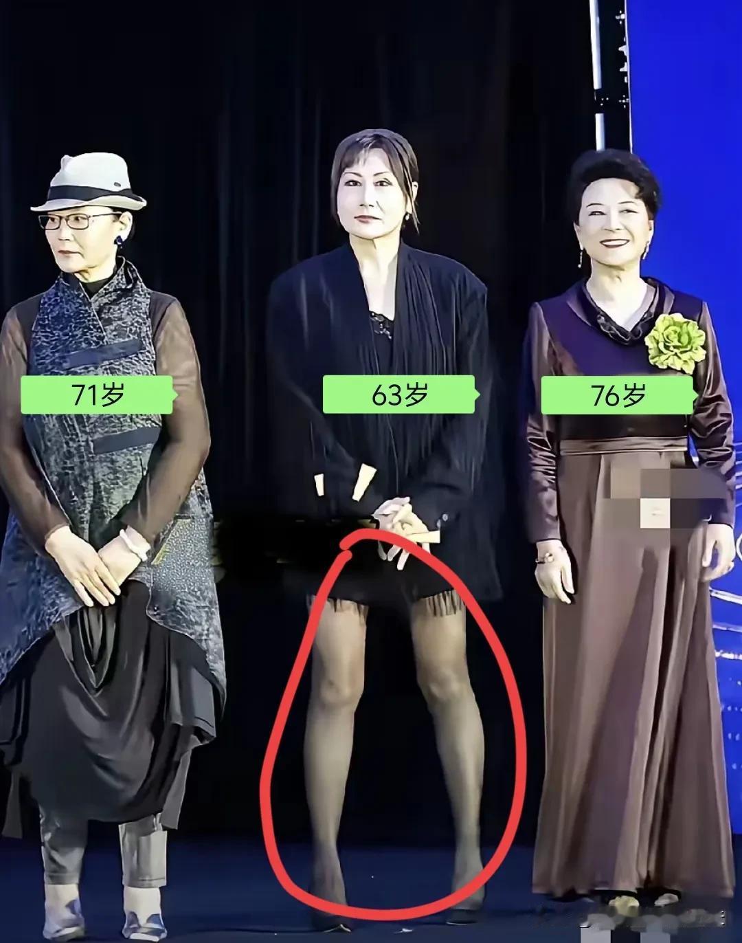 张凯丽这一身黑丝造型，我邻居李奶奶看了直摇头。她昨天盯着手机屏幕好久，嘴里