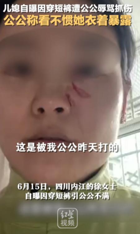 “清官难断家务事！”四川，一儿媳因天气热穿了条白色短裤，竟被50多岁的公公指着鼻