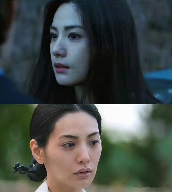 林珍娜整商整容后期总要出很多后遗症的，挺正常曾被奉为“整容界天花板”的林珍娜，