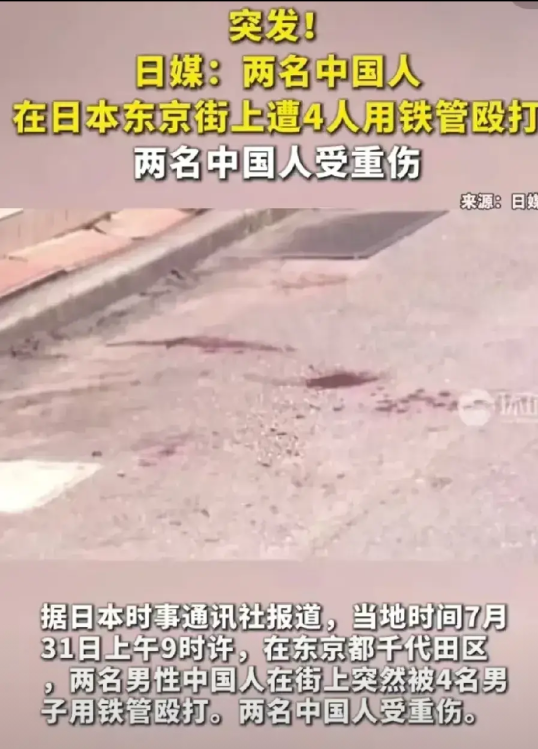 日本人在中国发生点什么事，国内媒体和大V就一窝蜂地炒作，把国人说得一文不值，而这
