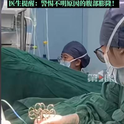 “离大谱！”浙江女子减肥多年，180斤体重纹丝不动，没想到摔了一跤后，肚子突然“