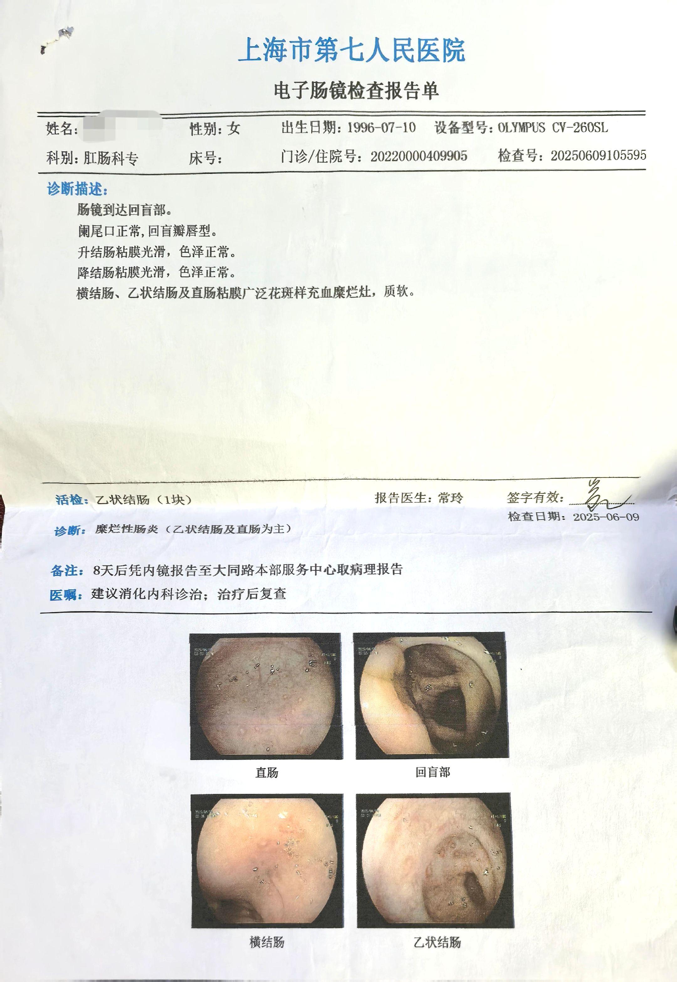 排除“非炎症性肠病”的患者也是临床的重点。 炎症性肠病，特指:溃疡性结...