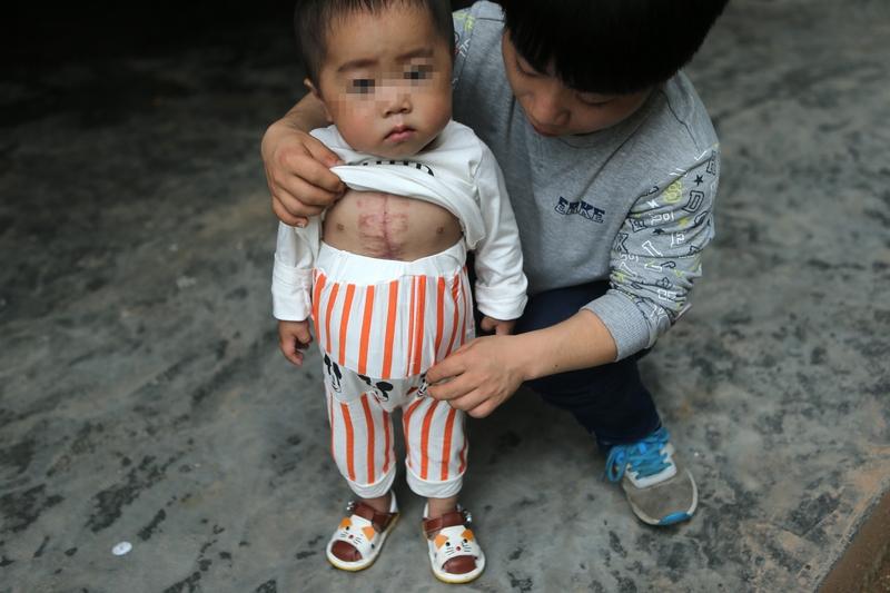 25岁小伙身高60厘米被妹妹抱着出门2月3日报道的这件事太让人感慨了。湖南25