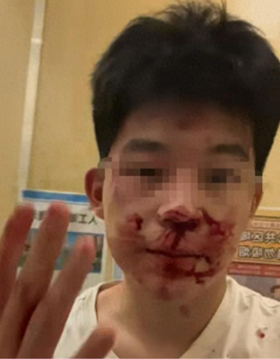 17岁男生被假民警骗出围殴，冒充民警打人者拘12天，借高考名义提前释放，想用22