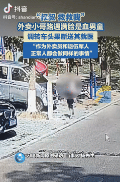 泪目了！湖北武汉，一男孩意外受伤满脸都是血，独自跑到马路上求救，可来往的路人看到