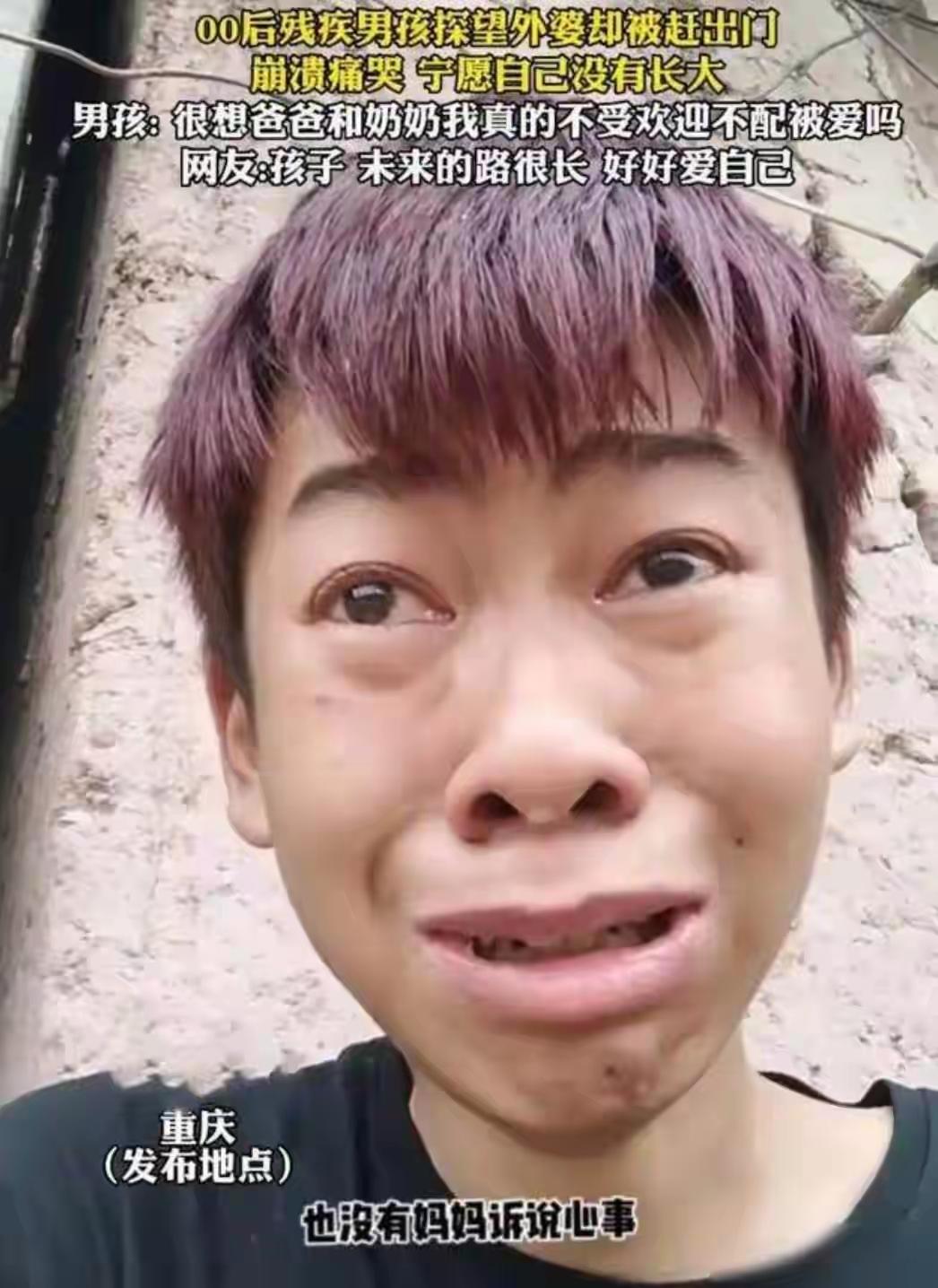 刷到一条少年的故事时，鼻子就有点堵得慌。这世上真的有人啊，光是活着，就已经拼尽全