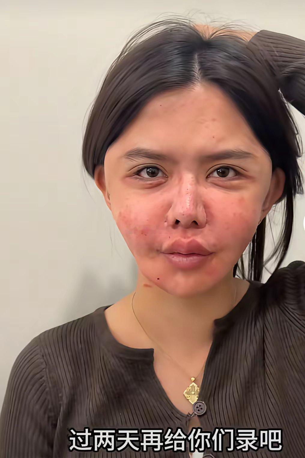 想变美先变鬼是真的吗这个网红韩安冉对自己真狠把自己脸整成这样子让人看着慎得慌