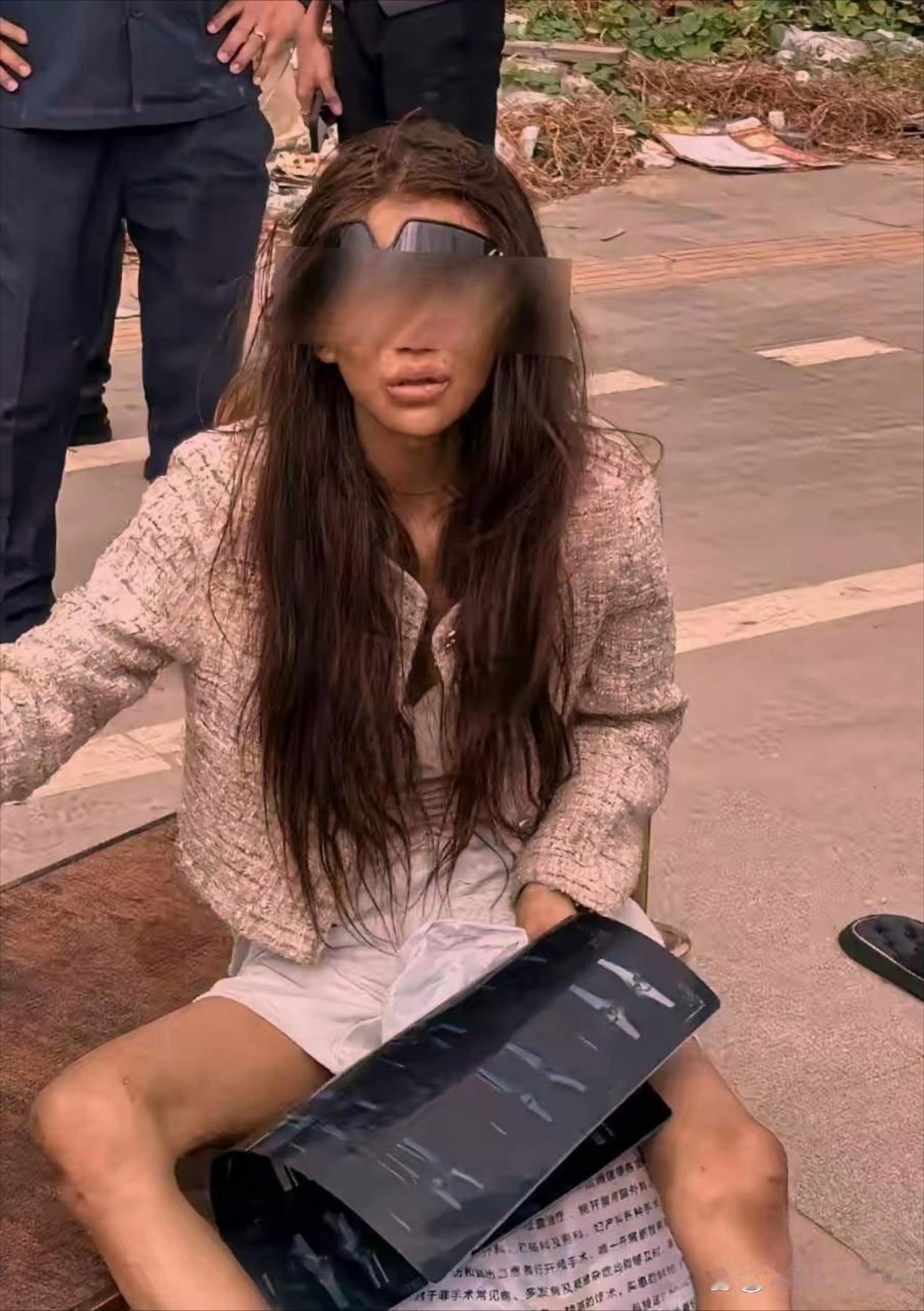 看了柬埔寨那个流浪女孩的检查结果，真的吓到我了！毒品检测呈阳性，一身的病