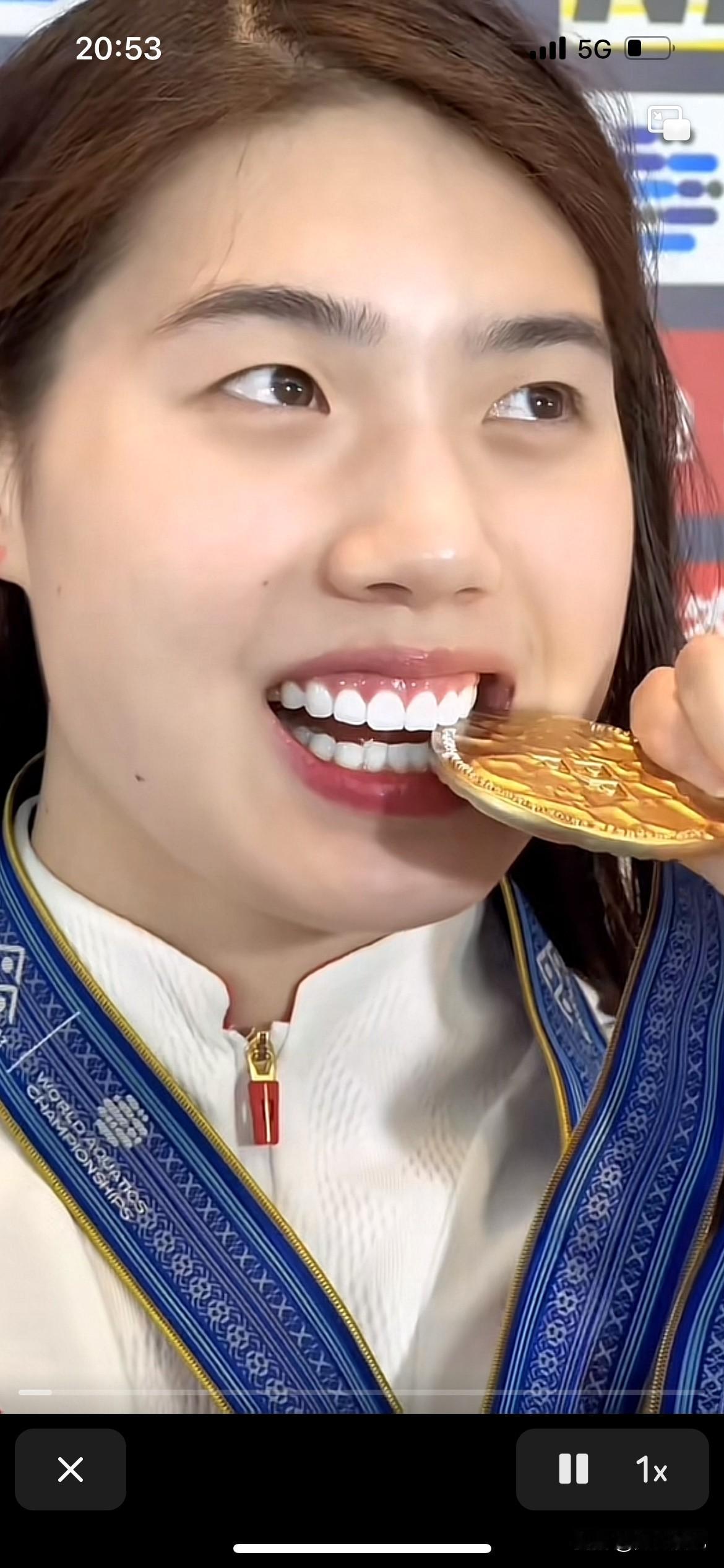 张雨霏也开始医整，这个牙齿肯定有问题，正常人都不会有那么白的牙齿，嘴巴太大了，整