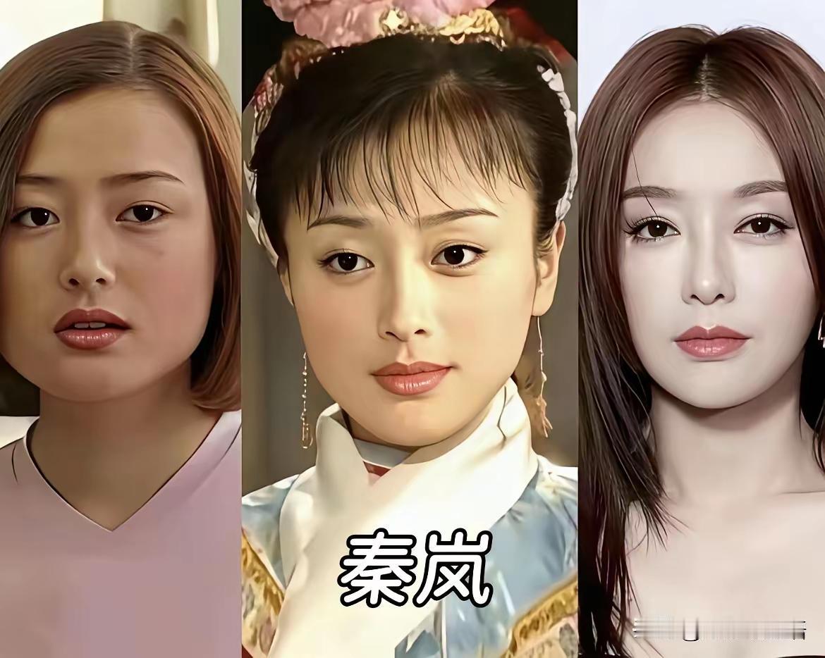 秦岚如果不整就凭她的原生脸早早能嫁入豪门了圆脸大眼就是通行证酸酸甜甜秦岚