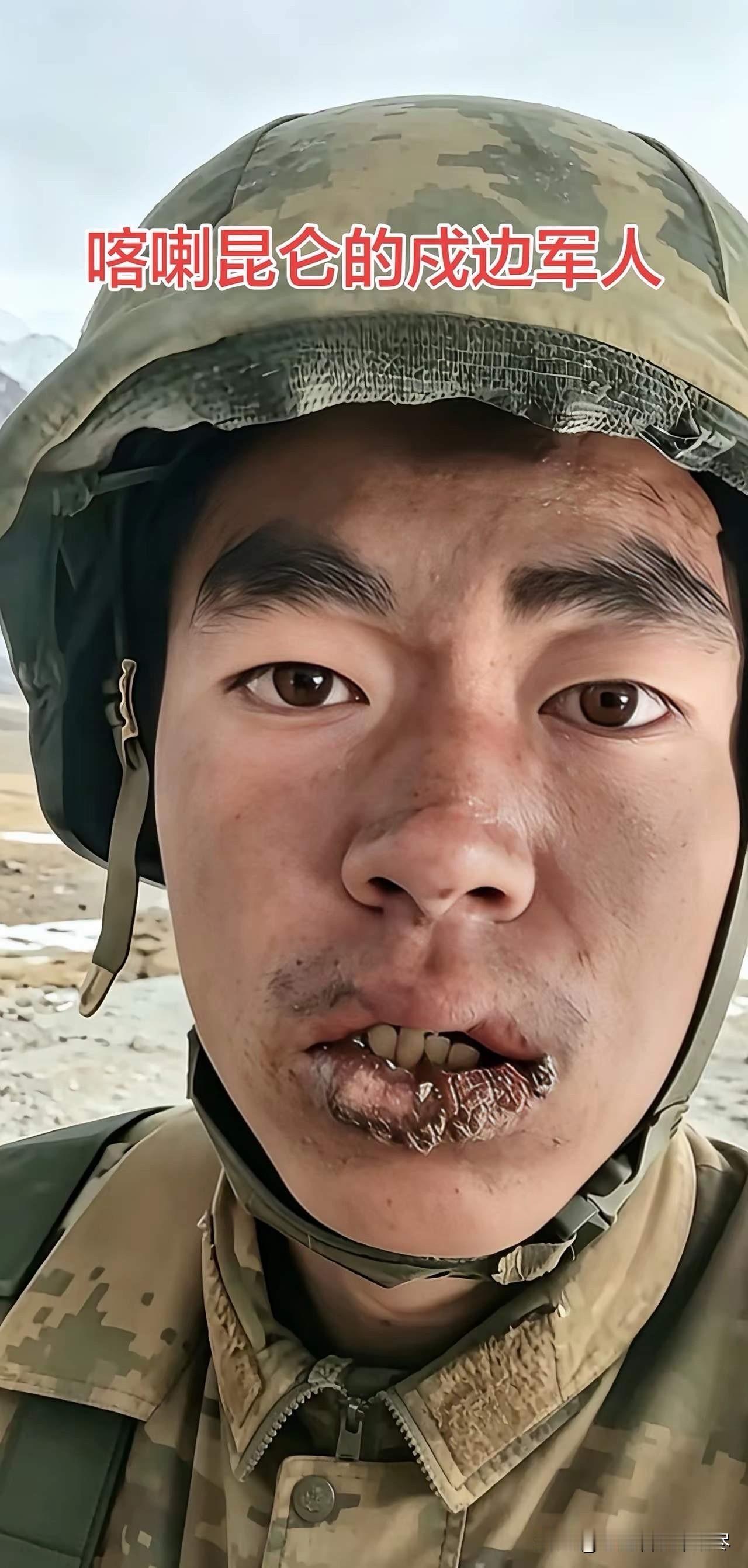 真的不敢去想这位戍边战士的父母，要是看到这一幕的话，她们是该有多心疼的自己的孩子