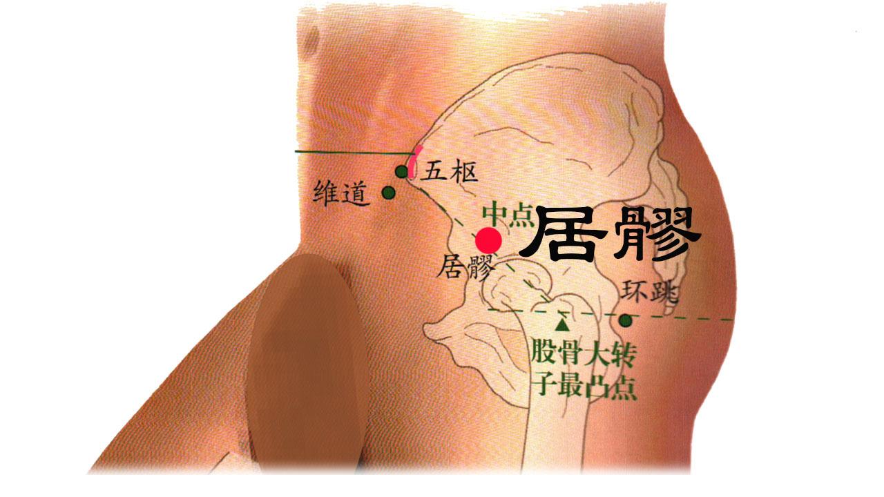 你知道吗? 大腿疼痛太异常, 其实是得了股外侧皮神经炎