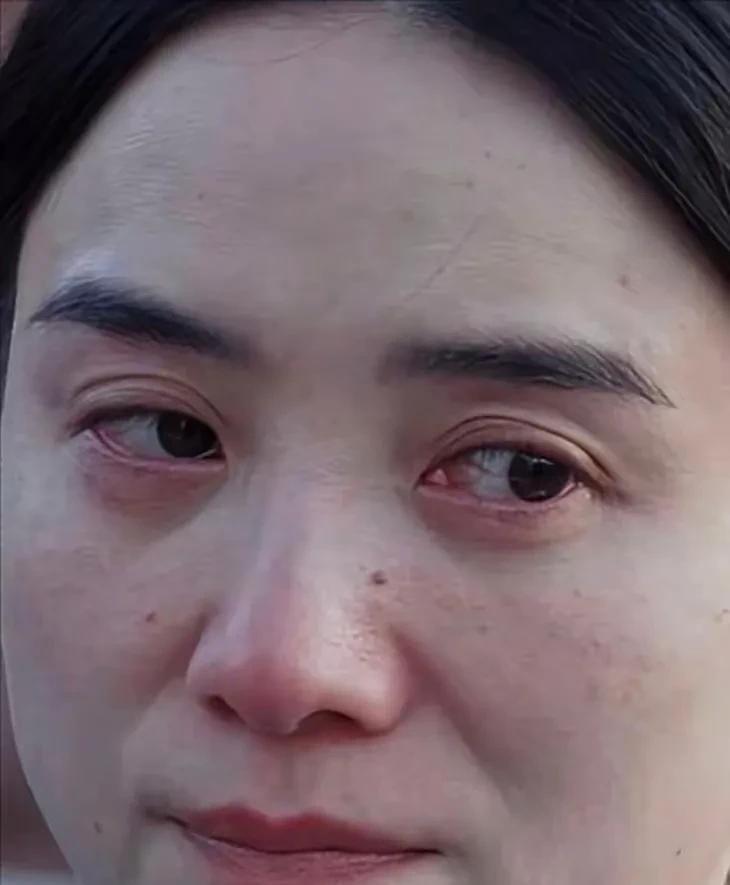 老天奶耶！这是宋佳真真实实的脸。这雀斑、这塌鼻子、这鼻翼两边的八字沟壑，说