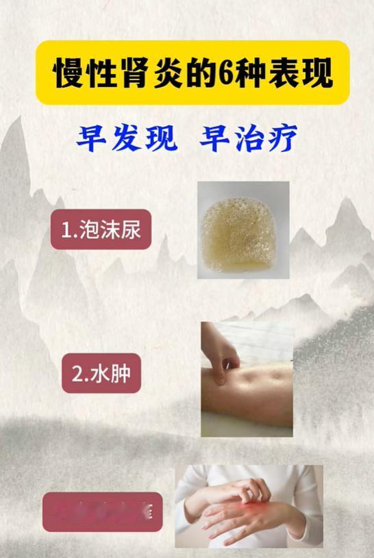 慢性肾炎六大典型身体表现，早察觉才能及时调养