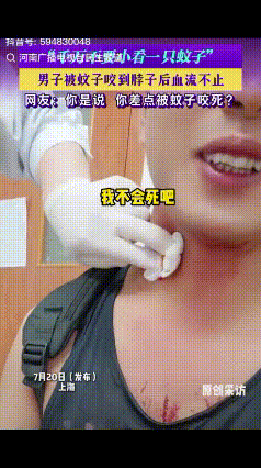 “差点成了被蚊子咬死的第一人！”上海一男子被蚊子咬了一口，脖子就血流不止，出现头