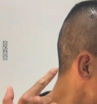 拳手周润琪在澳遇袭受伤昏迷，金腰带周润琪遇袭凶手被抓获10月16日，职业拳击