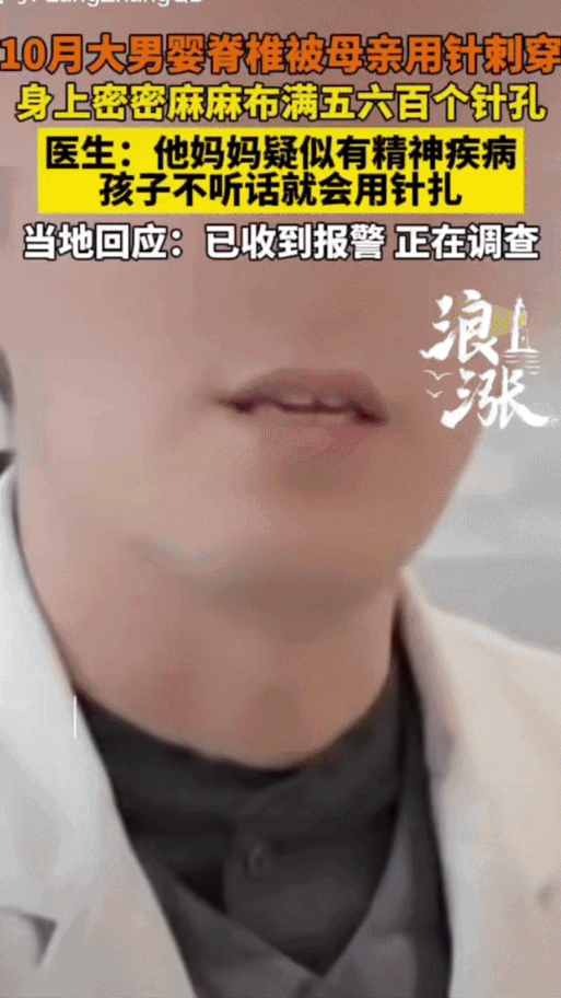 太心狠了！云南昆明，有一名医生爆料，一个只有10月大的婴儿，全身被扎了几百个针孔