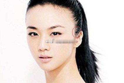 你知道鬓角上长痣代表什么意思吗手相面相算命情感鬓角上长痣这是吉相，表示你婚姻会很理想，家庭生活和谐，