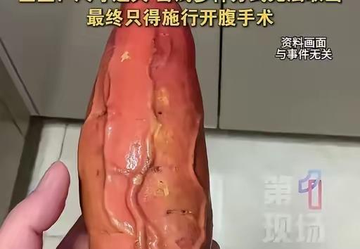 离谱至极！61岁大叔轻信偏方，硬生生把自己送进手术室