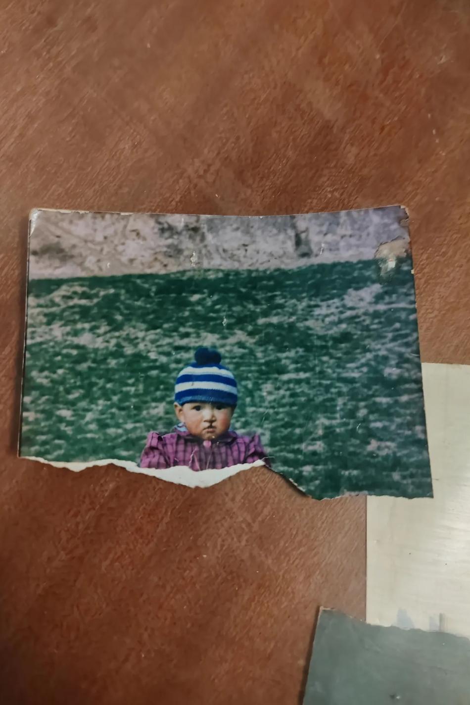 你能相信这是同一个人吗？当年因为唇腭裂太自卑，甚至把童年的照片全部都撕掉了，19