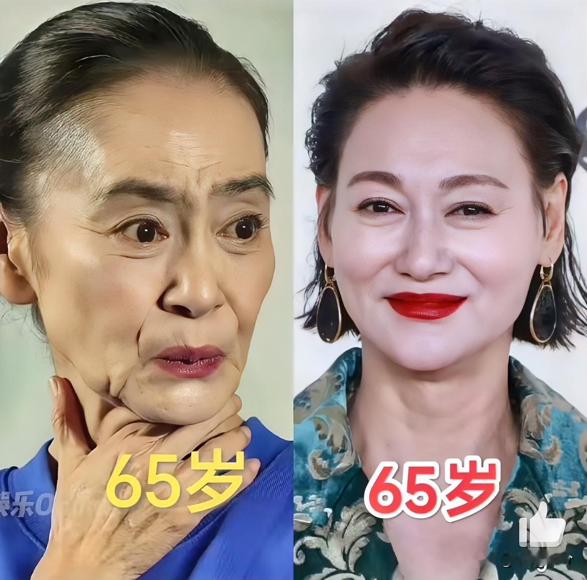 女人上了一定年龄可以不医美，也可以不漂亮，但千万别太瘦了，不信你看看惠英红和