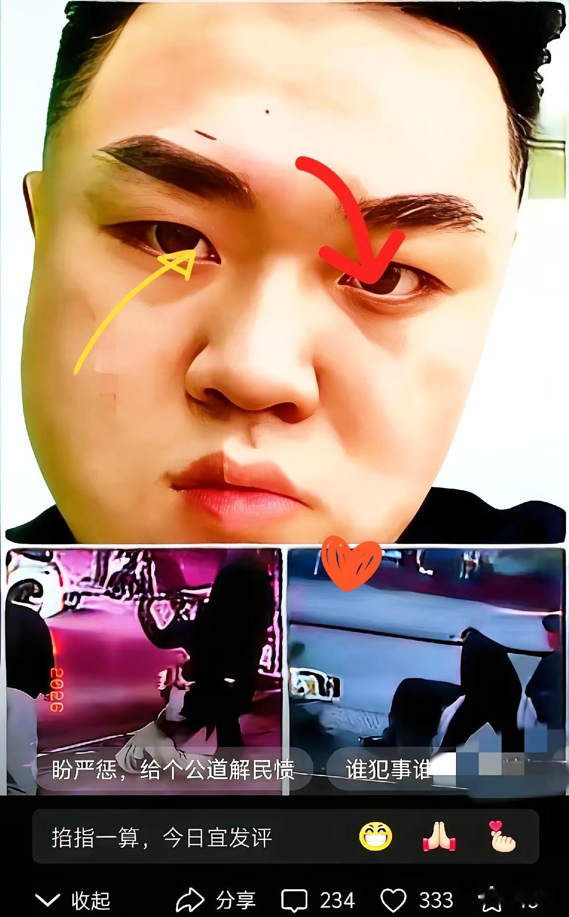 这俩货现在是真急眼了，据说满世界找关系，打算拿钱把这烂摊子给平了。我就想笑，