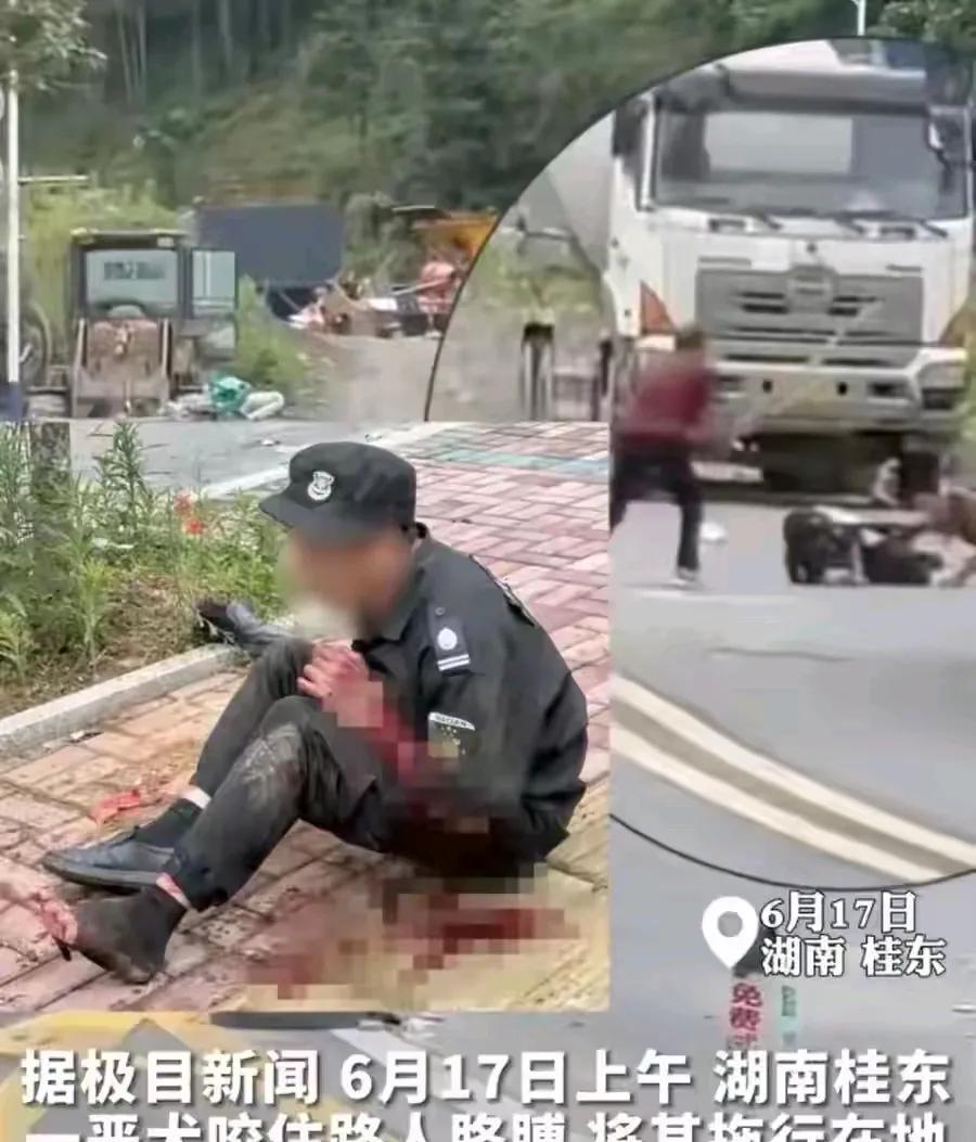 各地养狗伤人的新闻，时有发生，甚至是，比特犬这类烈性犬伤人的新闻，竟然也已经见怪
