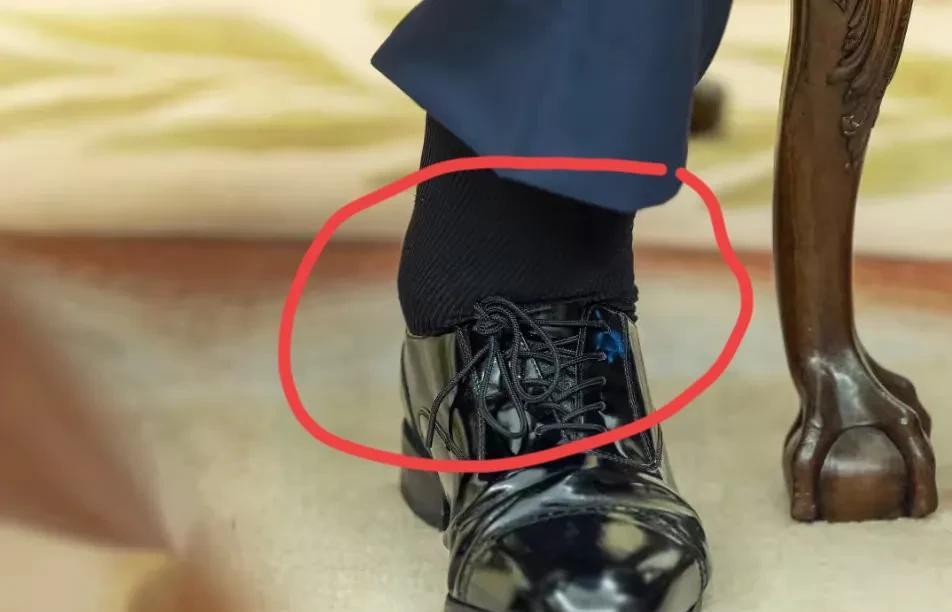 这是特朗普的脚仔细看肿的把皮鞋都撑的没有缝隙，原因白宫称他患有慢性静脉功能不全