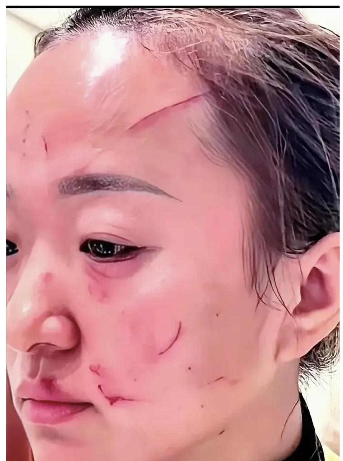 这事儿，看得人心惊肉跳。又是一起令人心痛的事件发生了，儿媳妇被婆婆挠得满脸是