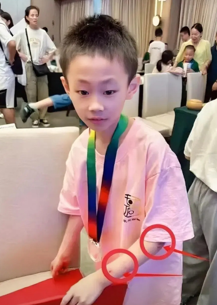 九岁的围棋天才朱宏鑫走了，他不是死于意外，不是死于岁月，也不是死于贫穷，没想